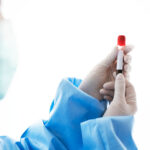 Transaminases élevées : quand s’inquiéter ?